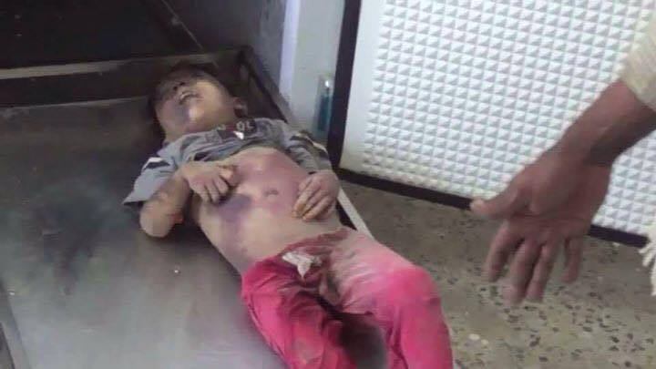 yemeni children and women, victim of saudi aggression on yemen